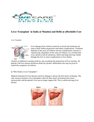 Liver Transplant in India at Mumbai and Delhi at affordable Cost


Liver Transplant



                           Liver damage from cirrhosis cannot be reversed, but treatment can
                           stop or delay further progression and reduce complications. Treatment
                           depends on the cause of cirrhosis and any complications a person is
                           experiencing. Regardless of the cause of cirrhosis, it is essential that
                           every patient avoid all substances, habits and drugs that may further
                           damage the liver or cause complications or liver failure.

Alcohol, in addition to causing cirrhosis, may accelerate the progression of liver scarring. All
patients with liver disease should not drink any alcohol. Medications also may be given to
control the symptoms of cirrhosis.


Q. Who Needs a Liver Transplant ?

Medical treatment for liver diseases and liver damage is always the first choice of therapy. The
only reason to perform a liver transplant is that all other forms of treatment have been
unsuccessful, and the patient's liver can no longer support life. This is called end stage liver
disease.
 