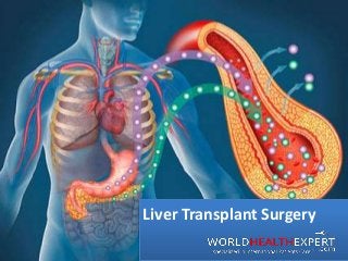 Liver Transplant Surgery
 