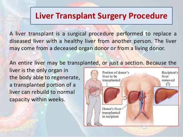 Liver Transplant Surgery Recovery OSUUA Liver Transplant Surgery Recovery OSUUA