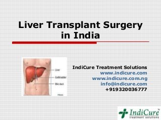Liver Transplant Surgery
         in India


          IndiCure Treatment Solutions
                    www.indicure.com
                 www.indicure.com.ng
                     info@indicure.com
                       +919320036777
 