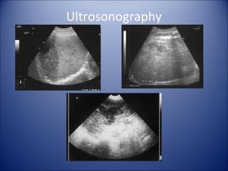 Ultrosonography
 
