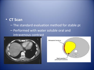 • CT Scan
  – The standard evaluation method for stable pt
  – Performed with water soluble oral and
    intravenous contrast
 