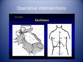 Operative interventions
 