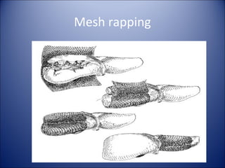 Mesh rapping
 