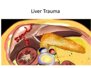 Liver Trauma 
 