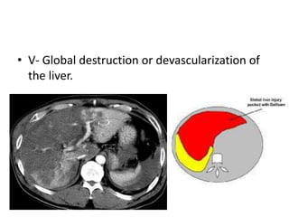 Liver trauma: A comprehensive review of classification, mechanisms ...