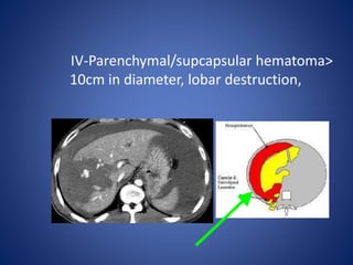 IV-Parenchymal/supcapsular hematoma>
10cm in diameter, lobar destruction,
 
