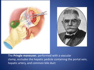 Liver Trauma PPT Liver Trauma PPT