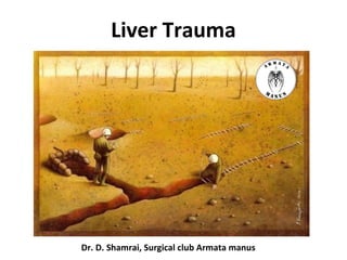 Liver Trauma
Dr. D. Shamrai, Surgical club Armata manus
 