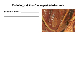 Pathology of  Fasciola hepatica  infections Immature adults  - ________________ ________________________________ 
