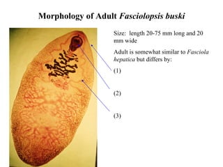 Morphology of Adult  Fasciolopsis buski Size:  length 20-75 mm long and 20 mm wide Adult is somewhat similar to  Fasciola hepatica  but differs by:  (1)  (2)  (3)    