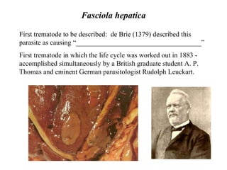 Fasciola hepatica First trematode to be described:  de Brie (1379) described this  parasite as causing “____________________________________” First trematode in which the life cycle was worked out in 1883 -  a ccomplished simultaneously by a British graduate student A. P. Thomas and eminent German parasitologist Rudolph Leuckart. 