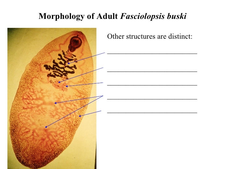Fasciolopsis Buski And Fasciola Hepatica