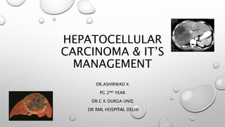 HEPATOCELLULAR 
CARCINOMA & IT’S 
MANAGEMENT 
DR.ASHIRWAD K 
PG 2ND YEAR 
DR.C K DURGA UNIT 
DR RML HOSPITAL DELHI 
 