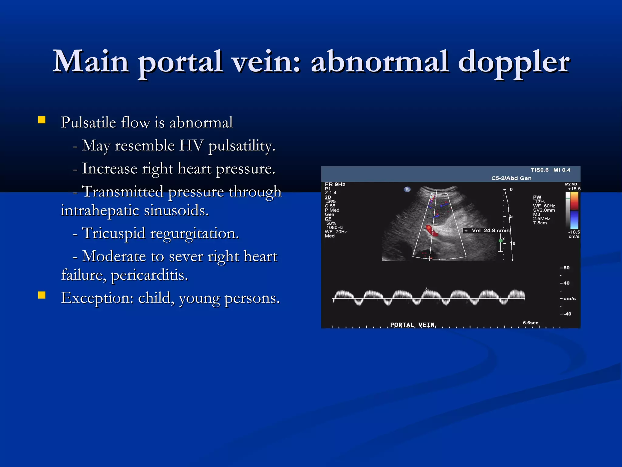 Main portal vein: abnormal dopplerMain portal vein: abnormal doppler
 Pulsatile flow is abnormalPulsatile flow is abnormal
- May resemble HV pulsatility.- May resemble HV pulsatility.
- Increase right heart pressure.- Increase right heart pressure.
- Transmitted pressure through- Transmitted pressure through
intrahepatic sinusoids.intrahepatic sinusoids.
- Tricuspid regurgitation.- Tricuspid regurgitation.
- Moderate to sever right heart- Moderate to sever right heart
failure, pericarditis.failure, pericarditis.
 Exception: child, young persons.Exception: child, young persons.
 