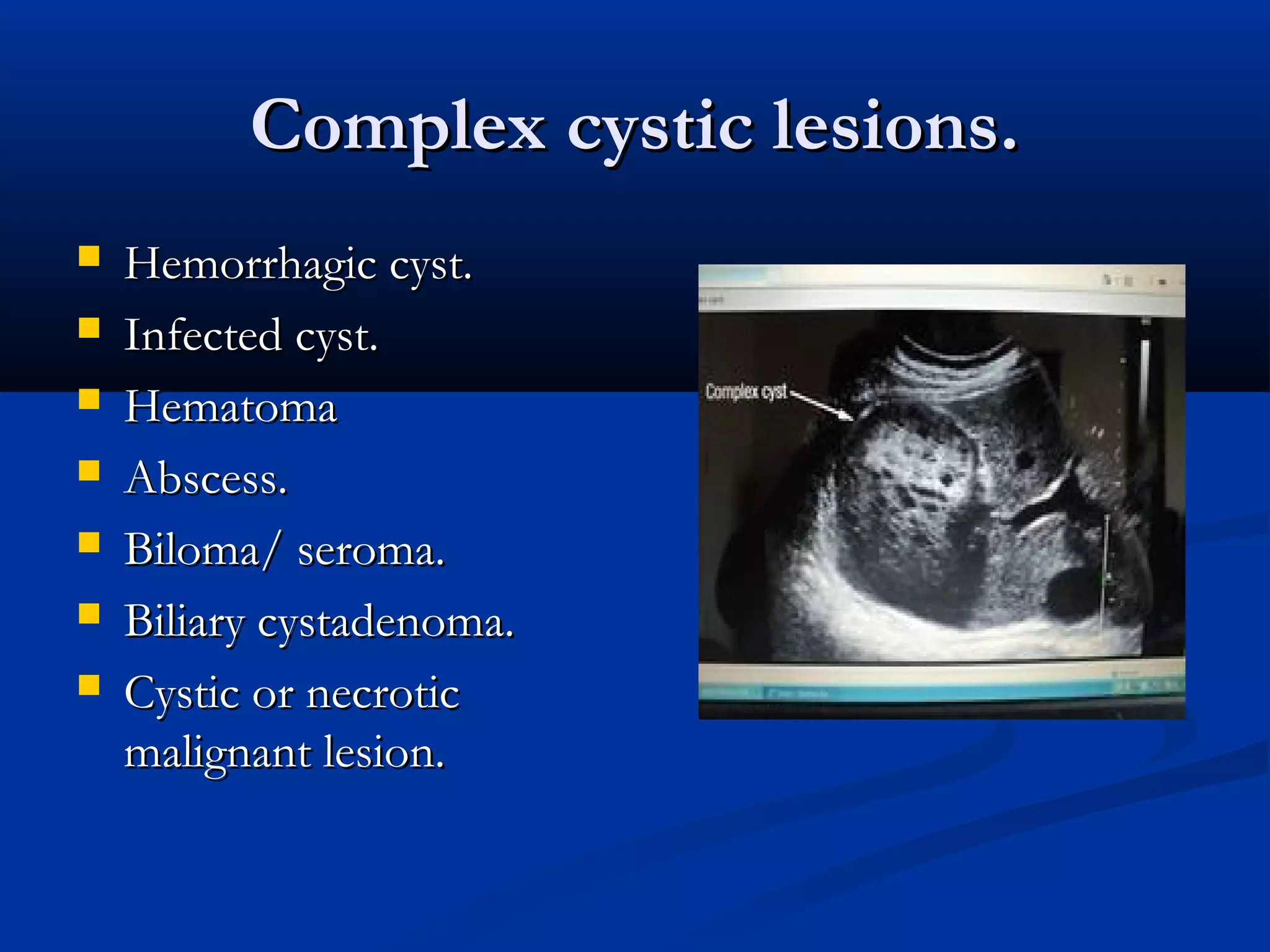 Complex cystic lesions.Complex cystic lesions.
 Hemorrhagic cyst.Hemorrhagic cyst.
 Infected cyst.Infected cyst.
 HematomaHematoma
 Abscess.Abscess.
 Biloma/ seroma.Biloma/ seroma.
 Biliary cystadenoma.Biliary cystadenoma.
 Cystic or necroticCystic or necrotic
malignant lesion.malignant lesion.
 