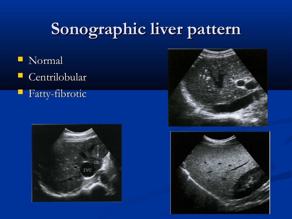 Liver ultrasound