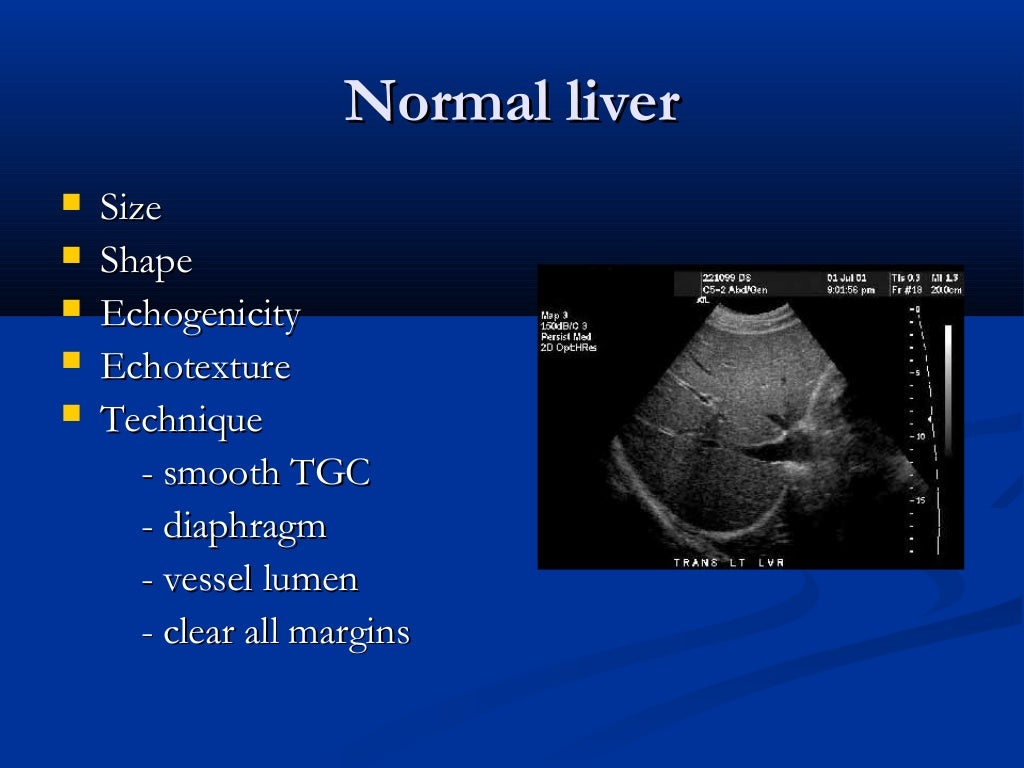 Liver ultrasound