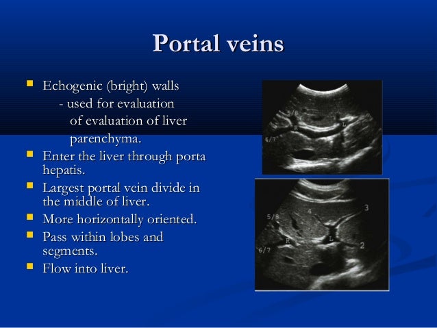 What is an echogenic liver?