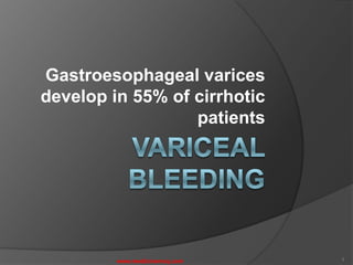 Gastroesophageal varices
develop in 55% of cirrhotic
patients
1
www.medicinemcq.com
 