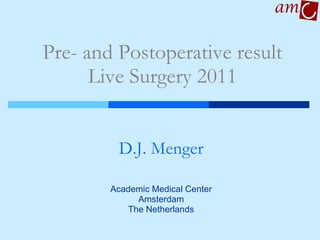 Pre- and Postoperative result Live Surgery 2011 D.J. Menger Academic Medical Center Amsterdam The Netherlands 