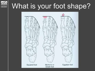 What is your foot shape?
 