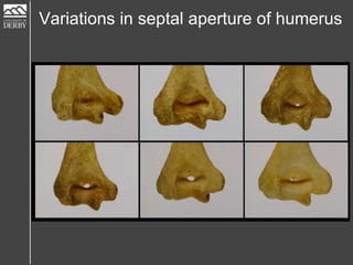 Variations in septal aperture of humerus
 