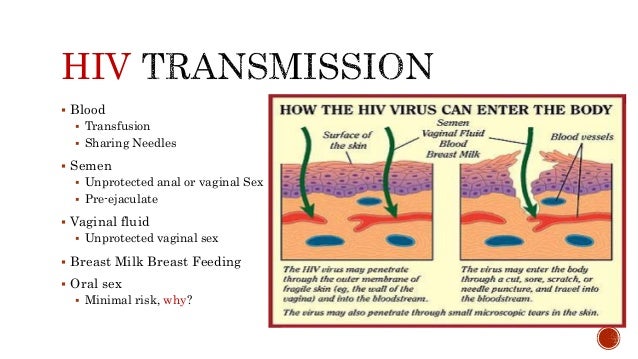 Aids Transmission Oral Sex 93