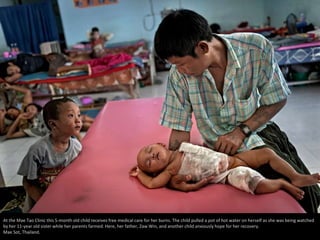 At the Mae Tao Clinic this 5-month old child receives free medical care for her burns. The child pulled a pot of hot water on herself as she was being watched 
by her 11-year old sister while her parents farmed. Here, her father, ZawWin, and another child anxiously hope for her recovery. 
Mae Sot, Thailand. 
 