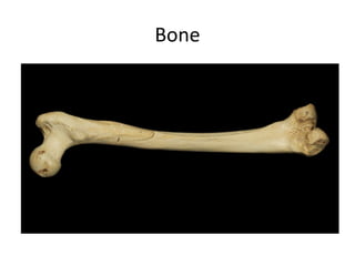Bone
 