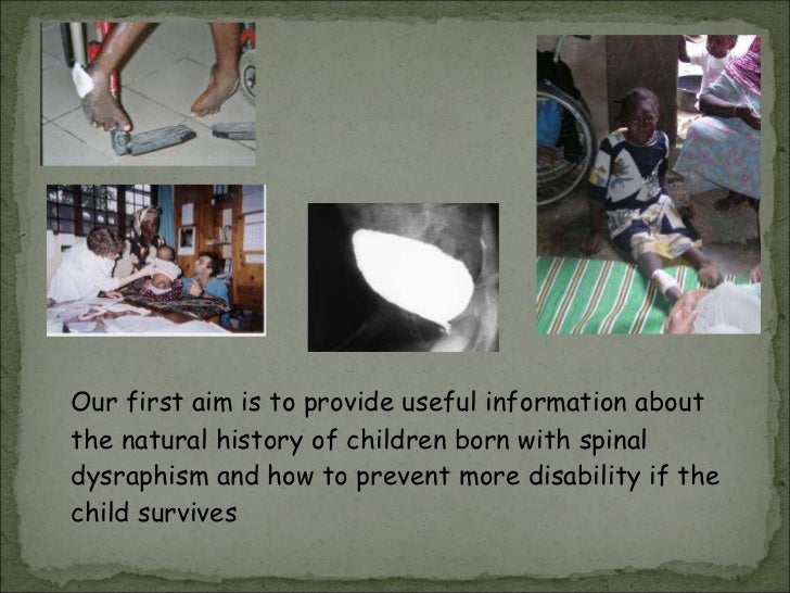 Spina Bifida Natural History Spina Bifida Natural History