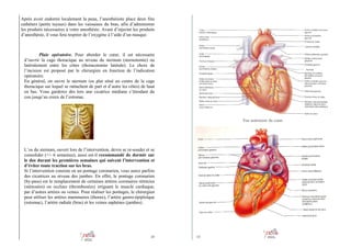 Après avoir endormi localement la peau, l’anesthésiste place deux fins
cathéters (petits tuyaux) dans les vaisseaux du bras, afin d’administrer
les produits nécessaires à votre anesthésie. Avant d’injecter les produits
d’anesthésie, il vous fera respirer de l’oxygène à l’aide d’un masque.

Planches anatomiques.

Plaie opératoire. Pour aborder le cœur, il est nécessaire
d’ouvrir la cage thoracique au niveau du sternum (sternotomie) ou
latéralement entre les côtes (thoracotomie latérale). Le choix de
l’incision est proposé par le chirurgien en fonction de l’indication
opératoire.
En général, on ouvre le sternum (os plat situé au centre de la cage
thoracique sur lequel se rattachent de part et d’autre les côtes) de haut
en bas. Vous garderez dès lors une cicatrice médiane s’étendant du
cou jusqu’au creux de l’estomac.

Vue antérieure du cœur.

L’os du sternum, ouvert lors de l’intervention, devra se re-souder et se
consolider (+/- 6 semaines), aussi est-il recommandé de dormir sur
le dos durant les premières semaines qui suivent l’intervention et
d’éviter toute traction sur les bras.
Si l’intervention consiste en un pontage coronarien, vous aurez parfois
des cicatrices au niveau des jambes. En effet, le pontage coronarien
(by-pass) est le remplacement de certaines artères coronaires rétrécies
(sténosées) ou occlues (thrombosées) irriguant le muscle cardiaque,
par d’autres artères ou veines. Pour réaliser les pontages, le chirurgien
peut utiliser les artères mammaires (thorax), l’artère gastro-épiploïque
(estomac), l’artère radiale (bras) et les veines saphènes (jambes).

18

15

 