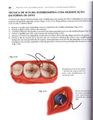 Livro   princípios de sutura em odontologia odontostation@gmail.com
