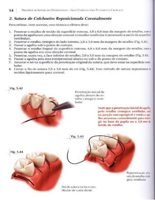 Livro   princípios de sutura em odontologia odontostation@gmail.com