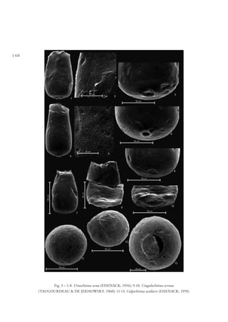 140
Fig. 3 – 1-8. Urnochitina urna (EISENACK, 1934); 9-10. Cingulochitina serrata
(TAUGOURDEAU & DE JEKHOWSKY, 1960); 11-13. Calpichitina acollaris (EISENACK, 1959).
 