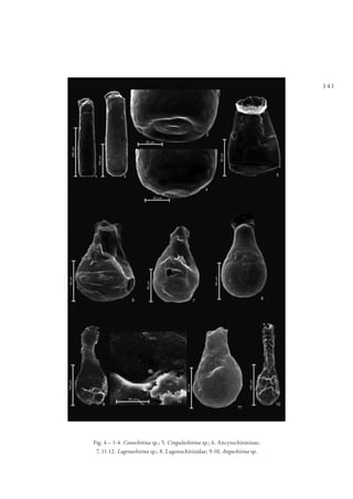 141
Fig. 4 – 1-4. Conochitina sp.; 5. Cingulochitina sp.; 6. Ancyrochitininae;
7, 11-12. Lagenochitina sp.; 8. Lagenochitinidae; 9-10. Angochitina sp.
 