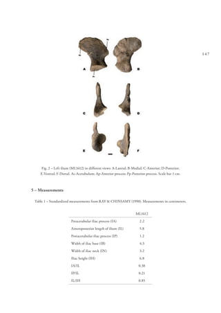 147
Fig. 2 – Left ilium (ML1612) in different views: A-Lateral; B-Medial; C-Anterior; D-Posterior;
E-Ventral; F-Dorsal. Ac-Acetabulum; Ap-Anterior process; Pp-Posterior process. Scale bar 1 cm.
5 – Measurements
Table 1 – Standardized measurements from RAY & CHINSAMY (1990). Measurements in centimeters.
ML1612
Preacetabular iliac process (IA) 2.2
Anteroposterior length of ilium (IL) 5.8
Postacetabular iliac process (IP) 1.2
Width of iliac base (IB) 4.3
Width of iliac neck (IN) 3.2
Iliac height (IH) 6.8
IA/IL 0.38
IP/IL 0.21
IL/IH 0.85
 