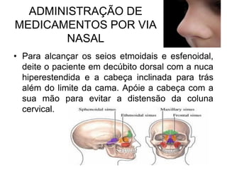 ADMINISTRAÇÃO DE
MEDICAMENTOS POR VIA
NASAL
• Para alcançar os seios etmoidais e esfenoidal,
deite o paciente em decúbito dorsal com a nuca
hiperestendida e a cabeça inclinada para trás
além do limite da cama. Apóie a cabeça com a
sua mão para evitar a distensão da coluna
cervical.

 