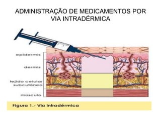 ADMINISTRAÇÃO DE MEDICAMENTOS POR
VIA INTRADÉRMICA

 