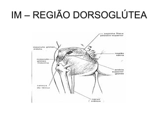 IM – REGIÃO DORSOGLÚTEA

 