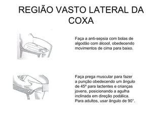 REGIÃO VASTO LATERAL DA
COXA
Faça a anti-sepsia com bolas de
algodão com álcool, obedecendo
movimentos de cima para baixo.

Faça prega muscular para fazer
a punção obedecendo um ângulo
de 45º para lactentes e crianças
jovens, posicionando a agulha
inclinada em direção podálica.
Para adultos, usar ângulo de 90°.

 