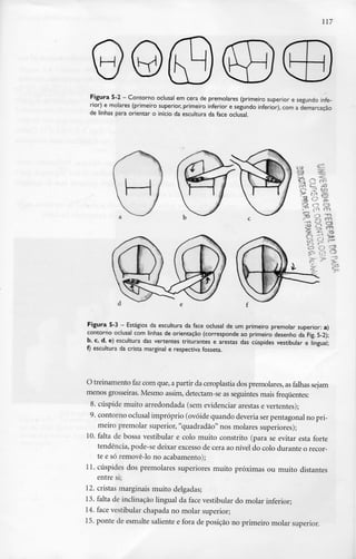 117




Figura 5-2 - Contorno oclusal em cera de premolares (primeiro superior e segundo infe-
rior) e molares (primeiro superior, primeiro inferior e segundo inferior), com a demarcação
de linhas para orientar o início da escultura da face oclusal.




Figura 5-3 - Estágios da escultura da face oclusal de um primeiro premolar superior: a)
contorno oclusal com linhas de orientação (corresponde ao primeiro desenho da Fig. 5-2);
b, c, d, e) escultura das vertentes triturantes e arestas das cúspides vestibular e lingual;
f) escultura da crista marginal e respectiva fosseta.




O treinamento faz com que, a partir da ceroplastia dos premolares, as falhas sejam
menos grosseiras. Mesmo assim, detectam-se as seguintes mais frequentes:
 8. cúspide muito arredondada (sem evidenciar arestas e vertentes);
 9. contorno oclusal impróprio (ovóide quando deveria ser pentagonal no pri-
    meiro premolar superior, "quadradão" nos molares superiores);
10. falta de bossa vestibular e colo muito constrito (para se evitar esta forte
    tendência, pode-se deixar excesso de cera ao nível do colo durante o recor-
    te e só removê-lo no acabamento);
11. cúspides dos premolares superiores muito próximas ou muito distantes
    entre si;
12. cristas marginais muito delgadas;
13. falta de inclinação lingual da face vestibular do molar inferior;
14. face vestibular chapada no molar superior;
15. ponte de esmalte saliente e fora de posição no primeiro molar superior.
 