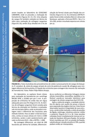 INVESTIGAÇÃOHISTOPATOLÓGICADOFÍGADOEINTESTINOEHEMATOLOGIADEJUVENISDOBEIJUPIRÁ,
Rachycentrumcanadum,ALIMENTADOSCOMCRESCENTESNÍVEISDEINCLUSÃODEFARELODESOJAEMDIETASPRÁTICAS
120
A B
C D
FIGURA 8.1. Fotos ilustrativas dos procedimentos de coleta e processamento de sangue do beijupi-
rá, R. canadum. A, coleta do sangue através do corte do pedúnculo caudal. B, esfregaços para con-
tagem diferencial de leucócitos. C, fixação dos eritrócitos para contagem dos mesmos. D, realização
do hematócrito. Fotos: Pedro Filipe Ribeiro Araújo.
serem levados ao laboratório do CEDECAM/
LABOMAR, onde se procedeu a realização do
hematócrito (Figuras 8.1 A e D). Uma alíquota
do sangue foi também coletada em lâmina de
vidro para realização do esfregaço sanguíneo
(Figura 8.1 B), sendo 10 μL diluídos em 2 mL de
solução de formol citrato para fixação dos eri-
trócitos (Figura 8.1 C). Os eritrócitos (ERITR) fi-
xados foram então contados (No) em câmara de
Neubauer, aplicado a fórmula ERITR = No x 5 x
10 x 200, sendo o resultado expresso em células
por μL.
Em laboratório, os capilares foram cheios
para realização do hematócrito em centrífuga
MICRO SPIN, a 10.000 rpm por 5 min. A pro-
porção de eritrócitos foi então lida em régua
adequada para esse fim (Figura 8.1 D). As lâmi-
nas de esfregaço sanguíneo foram coradas pela
técnica da coloração em Panótico e analisadas
sob microscopia óptica, onde se procedia à con-
tagem total e diferencial dos leucócitos pelo
método indireto. Para se obter o total de leucó-
citos, contou-se essas células em meio a 2.000
eritrócitos, sendo o valor posteriormente apli-
cado na fórmula LEUC = (No x ERITR) ÷ 1.000.
Na contagem diferencial, um total de 200
leucócitos por lâmina foi contado, diferencian-
do-os conforme as diferentes linhagens destas
células (neutrófilos, eosinófilos, basófilos e lin-
fócitos) usando-se marcador eletrônico para
contagem de células sanguíneas Kacil CCS–02.
Após a coleta do sangue, a cavidade celomá-
tica foi aberta com auxílio de pinças e bisturis
para exposição dos órgãos internos. Estes foram
observados quanto à integridade de suas estru-
turas, sendo então realizada a coleta de porções
do fígado, estômago, intestinos anterior, médio
e posterior (Figuras 8.2 A e B). Estas porções
coletadas foram imediatamente imersas em so-
lução de Davidson AFA para fixação. Os tecidos
foram mantidos por 24 h na solução de fixação,
substituída por solução alcoólica a 70%, quando
podiam então ser manipulados.
 