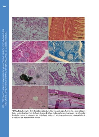 ESTABELECIMENTODEPROCEDIMENTOSDEDIAGNÓSTICOPADRÃOEPRINCIPAIS
ENFERMIDADESEMJUVENISDOBEIJUPIRÁ,Rachycentroncanadum(LINNAEUS,1766)
152
A
B
C
A
B
C
A A
FIGURA 9.12. Exemplos de lesões observadas durante a histopatologia. A, enterite ocasionada por
dietas contendo altos níveis de farelo de soja; B, difusa fusão das lamelas branquiais e proliferação
de células cloreto ocasionadas por desbalanço iônico; C, nefrite granulomatosa moderada focal
ocasionada por Septicemia bacteriana.
 