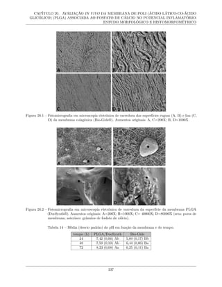 CAPÍTULO 20. AVALIAÇÃO IN VIVO DA MEMBRANA DE POLI (ÁCIDO LÁTICO-CO-ÁCIDO
GLICÓLICO) (PLGA) ASSOCIADA AO FOSFATO DE CÁLCIO NO POTENCIAL INFLAMATÓRIO:
ESTUDO MORFOLÓGICO E HISTOMORFOMÉTRICO
Figura 20.1 – Fotomicrografia em microscopia eletrônica de varredura das superfícies rugosa (A, B) e lisa (C,
D) da membrana colagênica (Bio-Gide®). Aumentos originais: A, C=200X; B, D=1000X.
Figura 20.2 – Fotomicrografia em microscopia eletrônica de varredura da superfície da membrana PLGA
(DuoSynth®). Aumentos originais: A=200X; B=1000X; C= 40000X; D=80000X (seta: poros de
membrana; asterisco: grânulos de fosfato de cálcio).
Tabela 14 – Média (desvio padrão) do pH em função da membrana e do tempo.
tempo (h) PLGA/DuoSynth Bio-Gide
24 7,42 (0,06) Ab 5,89 (0,17) Bb
48 7,59 (0,10) Ab 6,44 (0,06) Ba
72 8,23 (0,08) Aa 6,25 (0,11) Ba
237
 