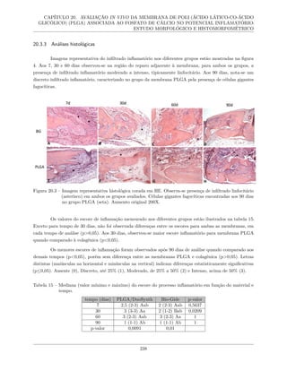 CAPÍTULO 20. AVALIAÇÃO IN VIVO DA MEMBRANA DE POLI (ÁCIDO LÁTICO-CO-ÁCIDO
GLICÓLICO) (PLGA) ASSOCIADA AO FOSFATO DE CÁLCIO NO POTENCIAL INFLAMATÓRIO:
ESTUDO MORFOLÓGICO E HISTOMORFOMÉTRICO
20.3.3 Análises histológicas
Imagens representativa do infiltrado inflamatório nos diferentes grupos estão mostradas na figura
4. Aos 7, 30 e 60 dias observou-se na região do reparo adjacente à membrana, para ambos os grupos, a
presença de infiltrado inflamatório moderado a intenso, tipicamente linfocitário. Aos 90 dias, nota-se um
discreto infiltrado inflamatório, caracterizado no grupo da membrana PLGA pela presença de células gigantes
fagocíticas.
Figura 20.3 – Imagem representativa histológica corada em HE. Observa-se presença de infiltrado linfocitário
(asterisco) em ambos os grupos avaliados. Células gigantes fagocíticas encontradas aos 90 dias
no grupo PLGA (seta). Aumento original 200X.
Os valores do escore de inflamação mensurado nos diferentes grupos estão ilustrados na tabela 15.
Exceto para tempo de 30 dias, não foi observada diferenças entre os escores para ambas as membranas, em
cada tempo de análise (p>0,05). Aos 30 dias, observou-se maior escore inflamatório para membrana PLGA
quando comparado à colagênica (p<0,05).
Os menores escores de inflamação foram observados após 90 dias de análise quando comparado aos
demais tempos (p<0,05), porém sem diferença entre as membranas PLGA e colagênica (p>0,05). Letras
distintas (maiúsculas na horizontal e minúsculas na vertical) indicam diferenças estatisticamente significativas
(p≤0,05). Ausente (0), Discreto, até 25% (1), Moderado, de 25% a 50% (2) e Intenso, acima de 50% (3).
Tabela 15 – Mediana (valor mínimo e máximo) do escore do processo inflamatório em função do material e
tempo.
tempo (dias) PLGA/DuoSynth Bio-Gide p-valor
7 2,5 (2-3) Aab 2 (2-3) Aab 0,5637
30 3 (3-3) Aa 2 (1-2) Bab 0,0209
60 3 (2-3) Aab 3 (2-3) Aa 1
90 1 (1-1) Ab 1 (1-1) Ab 1
p-valor 0,0091 0,01
238
 