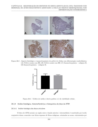 CAPÍTULO 26. REGENERAÇÃO DE DEFEITOS NO DISCO ARTICULAR DA ATM, TRATADOS COM
HIDROGEL DE ÁCIDO HIALURÔNICO ASSOCIADO A CÉLULAS TRONCO MESENQUIMAIS, COM
DIFERENCIAÇÃO CONDROGÊNICA
Figura 26.3 – Aspecto histológico e imunocitoquímico do pellets de células com diferenciação condroblástica:
(A) Pellets corado com HE; (B) Pellets corado com HE; (C) Imunocitoquímica – colágeno II;
(D) Imunocitoquímica – colágeno II.
Figura 26.4 – Gráfico de média e desvio padrão (±) da viabilidade celular.
26.3.4 Análise histológica, histomorfométrica e histoquímica do disco da ATM
26.3.4.1 Análise histológica dos discos articulares
O disco de ATM normal, na região entre a banda anterior e intermediária é constituído por tecido
conjuntivo denso, avascular com feixes espessos de fibras colágenas, orientados ao acaso, entremeados por
282
 