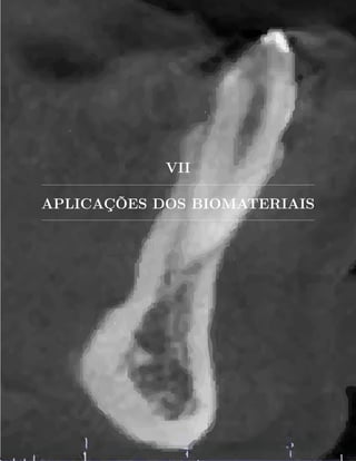 VII
APLICAÇÕES DOS BIOMATERIAIS
 
