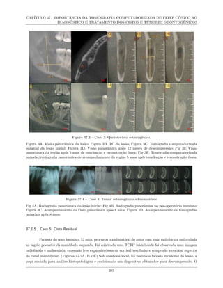 Livro Biomateriais 2023.pdf