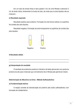74
Em um tubo de ensaio limpo e seco pipetar 3 mL de urina filtrada e adicionar 2
mL de ácido nítrico, lentamente no fundo do tubo, de modo que os dois líquidos não se
misturem.
e) Resultado esperado
Resultado positivo para proteína: Formação de anel branco leitoso na superfície
de contato dos dois líquidos.
Resultado negativo: Formação de anel transparente na superfície de contato dos
dois líquidos.
f) Resultado obtido
______________________________________________________________________
______________________________________________________________________
g) Interpretação do resultado
O resultado de proteinúria positiva é indicativo de lesão glomerular com perda da
proteína de alto peso molecular que normalmente não é filtrada pelo glomérulo intacto.
Determinação de Albumina na Urina – Método Sulfossalicílico
a) Fundamentação teórica
A reação consiste da desnaturação da proteína pelo ácido sulfossalicílico com
formação de metalproteína.
PositivoNegativo
 